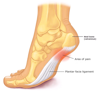 Plantar Facia Ligament