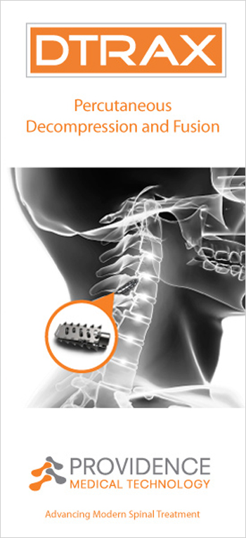 EsophyX TIF patient brochure