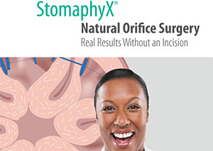StomaphyX Patient Brochure